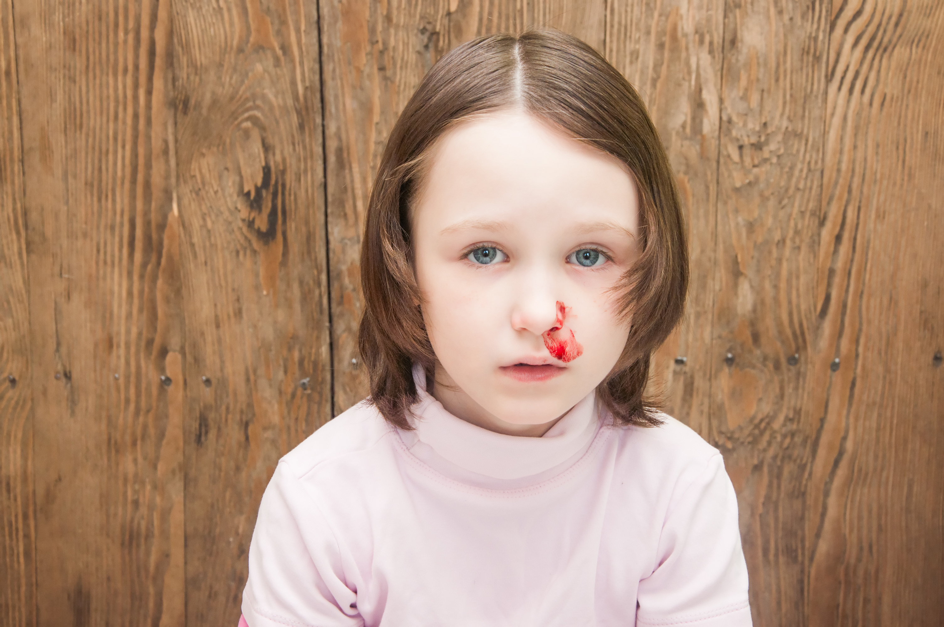 Nosebleeds In Children | Ask Dr Sears® | The Trusted Resource for ...