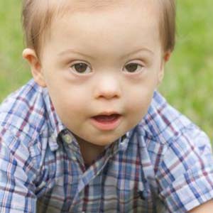 How Frequently Does Down Syndrome Occur?
