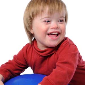 Why Does Down Syndrome Occur?