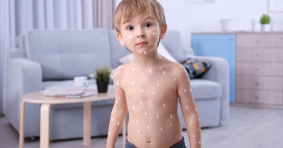 Is It A Viral Rash Baby Toddler Rash Identification Ask Dr Sears