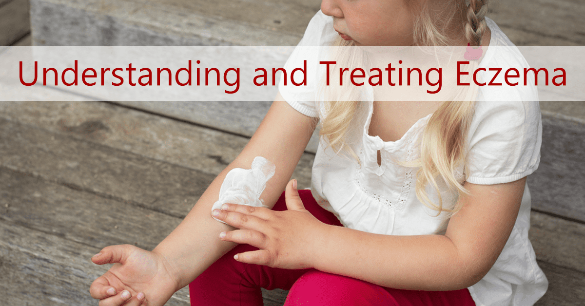 Treating Eczema In Toddlers Infants Ask Dr Sears